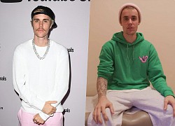 Justin Bieber "bức bối", lên tiếng kêu cứu vì liệt nửa mặt