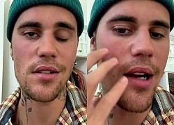 Justin Bieber mất 6 tháng để điều trị liệt cơ mặt