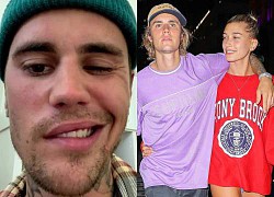 Justin Bieber và 1 năm đầy biến động: Vợ đột quỵ, chồng liệt nửa mặt