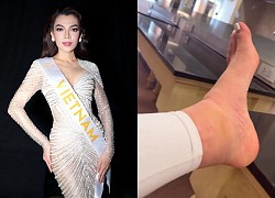 Xót xa bàn chân sưng đau của Trân Đài tại hậu trường - Sát giờ G chung kết Miss International Queen 2022