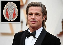 Nguy hiểm từ hội chứng mù mặt của Brad Pitt