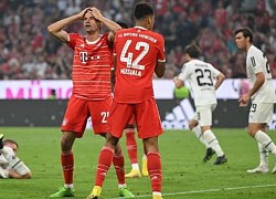 Bayern trải qua trận thứ 5 liên tiếp không thể đánh bại Gladbach