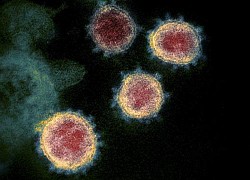 Trên 65.000 người nhiễm chủng các virus giống SARS-CoV ở Đông Nam Á mỗi năm