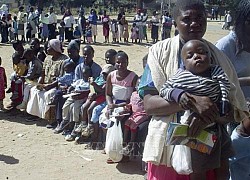 Zimbabwe: Tái bùng phát dịch sởi khiến 80 trẻ em tử vong