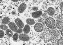 CDC Mỹ: Động vật nuôi có thể lây nhiễm virus đậu mùa khỉ từ người