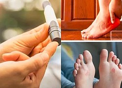 Đây là điều đáng sợ nhất ở bệnh nhân tiểu đường