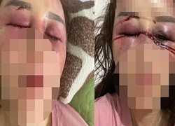 Thanh Hóa: Cán bộ QLTT bị 'tố' hành hung phụ nữ gãy xương hàm