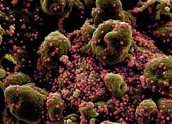 Phát hiện sinh vật đầu tiên trên thế giới chỉ ăn virus để sống