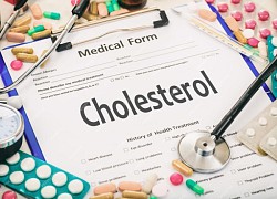 Bác sĩ: Dấu hiệu khi đi bộ cảnh báo mức cholesterol cao nguy hiểm