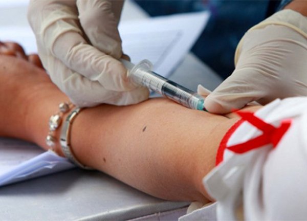 Người nhiễm HIV sống khỏe nhờ điều trị ARV sớm