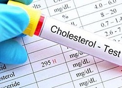 Nghiên cứu mới: 'Cholesterol tốt' không có lợi như người ta tưởng