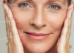 Bổ sung collagen bằng thực phẩm có hiệu quả không?