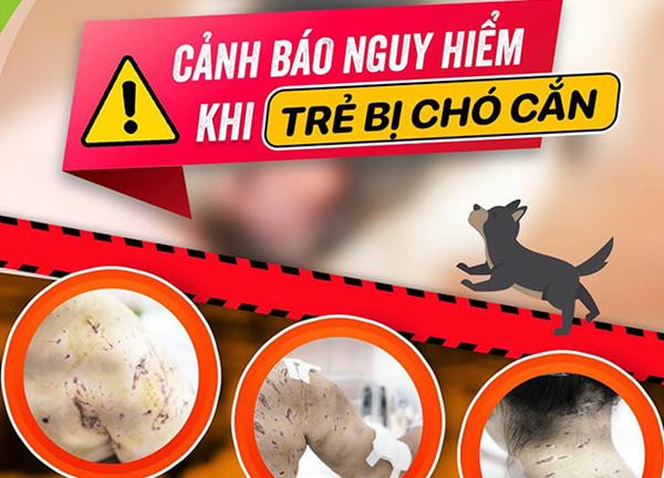 Bé gái bị 4 con chó tấn công với hàng trăm vết thương trên người