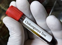 Mỹ phê duyệt vaccine đầu tiên trên thế giới ngừa virus Chikungunya