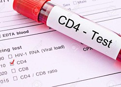 Những điều cần biết về số lượng CD4 và tải lượng virus ở người nhiễm HIV