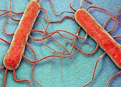 Mỹ cảnh báo nguy cơ bùng phát bệnh do vi khuẩn listeria