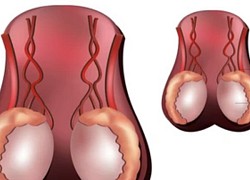 Bác sĩ lưu ý dấu hiệu đừng bỏ qua khi kiểm tra tinh hoàn