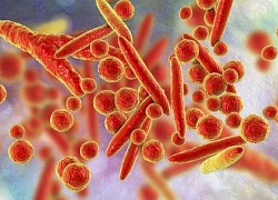 Cẩn trọng với các bệnh hô hấp do vi khuẩn Mycoplasma