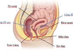 Cô gái chảy máu ổ bụng, tính mạng nguy kịch sau quan hệ tình dục