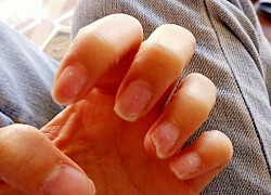 Tình trạng chung của chị em sau Tết: Làm nail hết mình, tháo nail hết hồn