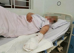 Hải Phòng: Bắt nhóm chém nạn nhân đứt lìa hai ngón tay