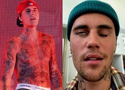 Justin Bieber tiếp tục hủy toàn bộ show diễn vì bệnh liệt mặt trở nặng: Tình trạng đáng báo động