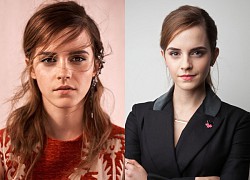 Emma Watson quản lý khối tài sản hơn 2.000 tỷ thế nào mà được khen nức nở?