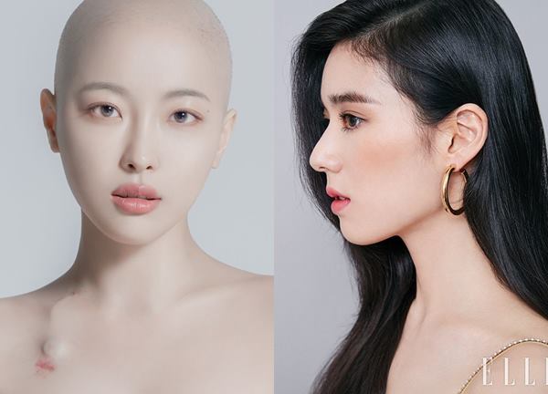 Những nguyên nhân bất ngờ khiến tóc mỏng trông thấy