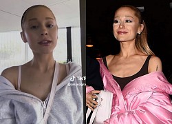 Ariana Grande lên tiếng về hình ảnh gầy đáng báo động, hé lộ chuyện quá khứ gây bất ngờ