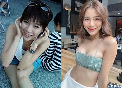 Bạn gái Mario Maurer công khai loạt ảnh trước khi phẫu thuật thẩm mỹ