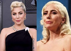 Lady Gaga mở lòng về những bí mật thầm kín: Sức khỏe tinh thần ở tình trạng báo động