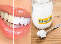 Bí quyết làm răng trắng tại nhà với baking soda