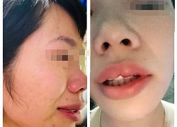 Vụ thầy giáo đánh cô chủ nhiệm của con: Phạt 6,5 triệu đồng, kiểm điểm và xem xét kỷ luật