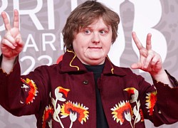 Lewis Capaldi hủy tất cả các buổi biểu diễn vì vấn đề sức khỏe