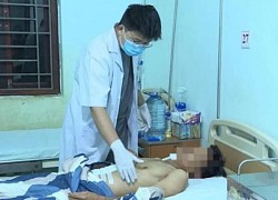 Đang ngủ bị bạn trai đột nhập, dùng dao đâm vào bụng