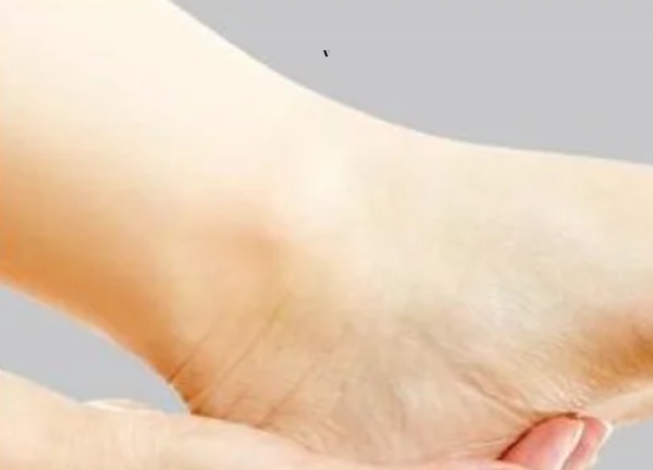 Cách hạn chế nứt gót chân