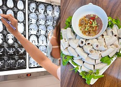 Sau bữa ăn lòng lợn, người phụ nữ viêm màng não nguy kịch, phải nhập viện thở oxy liều cao