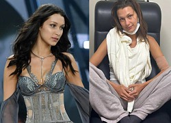 Thiên thần Victoria Secret &#8211; Bella hadid gầy trơ xương vì căn bệnh nghiệt ngã, anti ân hận vì 1 điều