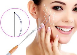 Nâng cơ mặt chảy xệ, nên chọn laser hay cấy chỉ?