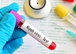 Bangladesh ghi nhận ca tử vong đầu tiên do virus Nipah