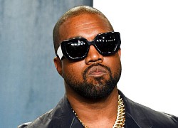 Kanye West gắn hàm răng giả hơn 20 tỉ đồng