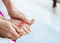 Bệnh gout có di truyền không?