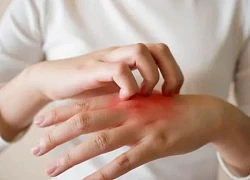 Bị ngứa vào ban đêm, đi khám mới biết chỉ còn sống được 8 tháng