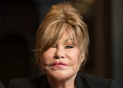 'Miêu nữ' Jocelyn Wildenstein gây sốc khi đăng ảnh trước và sau phẫu thuật thẩm mỹ