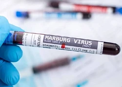 Nga, Kazakhstan tăng cường biện pháp ngăn chặn nguy cơ virus Marburg xâm nhập