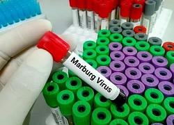 Rwanda triển khai thử nghiệm vaccine Marburg