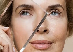 Bạn cần chú ý những gì khi sử dụng retinol vào mùa Đông?