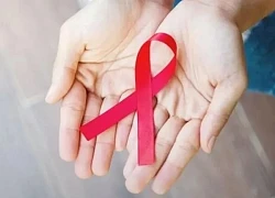 Giải trừ gánh nặng kép đồng nhiễm HIV/lao