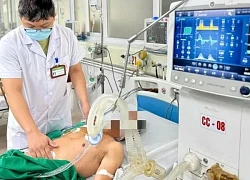 Mắc uốn ván từ khoang miệng