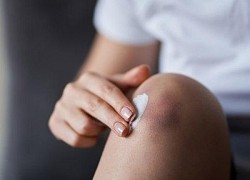 Vết bầm tím, chảy máu do dùng thuốc có nguy hiểm?